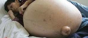 Doença que acontece com a Cirrose
